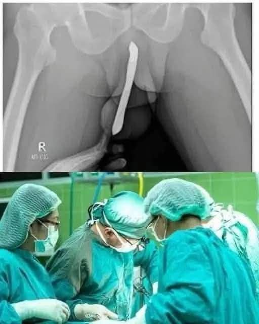 Doctors are speechless: Just boil these 2 ingredients and you will quickly lose your body fat !!